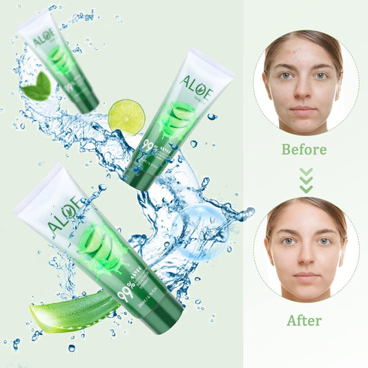 200X2 ML Gel Di Aloe Vera – Idratante Viso E Corpo Di Aloe Vera Pura 99% Organica, Crema Naturale Di Aloe per Pelle Secca, Scottature Solari, Acne, Lenitiva E Idratante